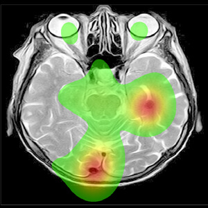 Applied Eye-Tracking Solutions -