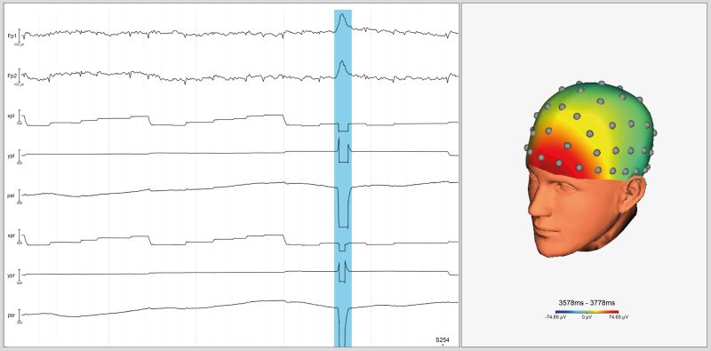 EyeLink-Brain Products Integration - SR Research