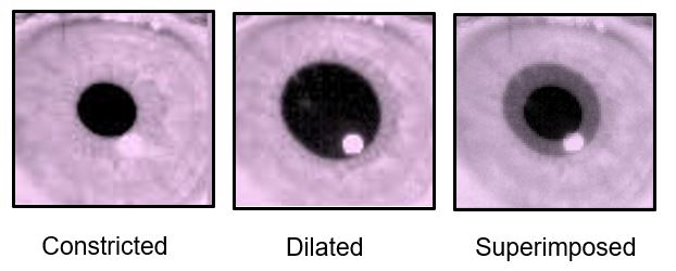 mind wandering pupil diameter