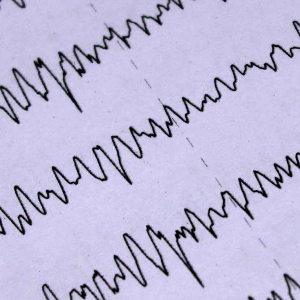 Eye Tracking, working memory, eeg