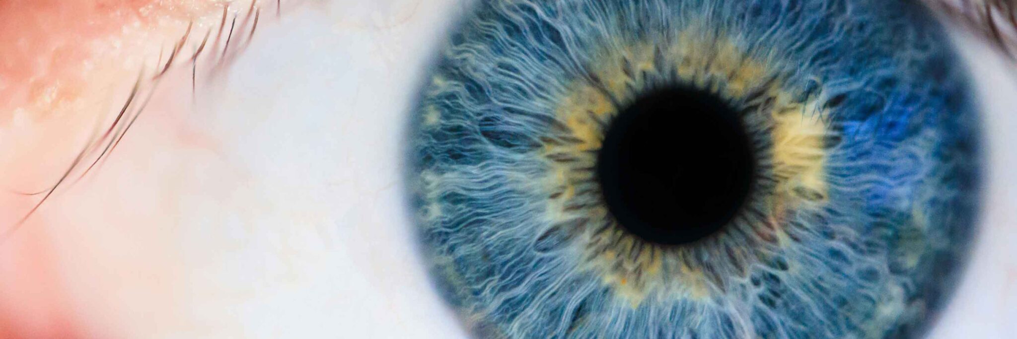 Eye Tracking Macular Degeneration and Motion Extrapolation