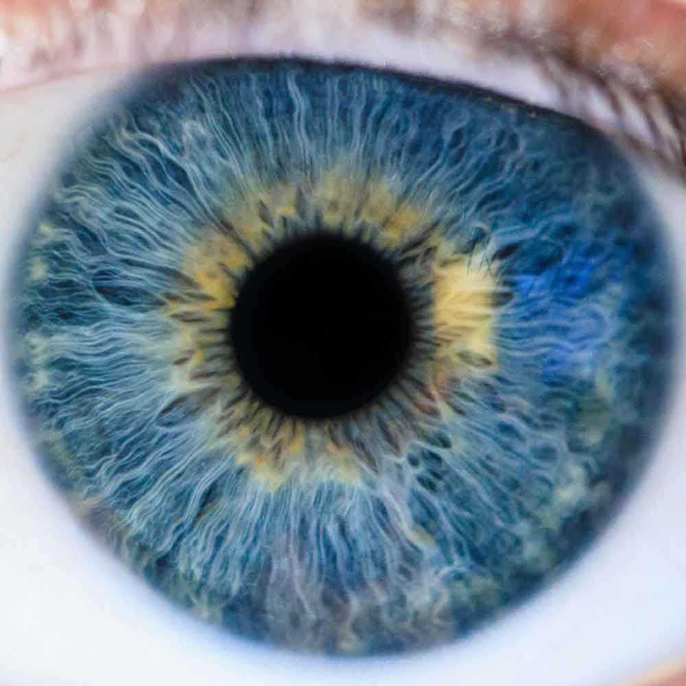 Eye Tracking Macular Degeneration and Motion Extrapolation